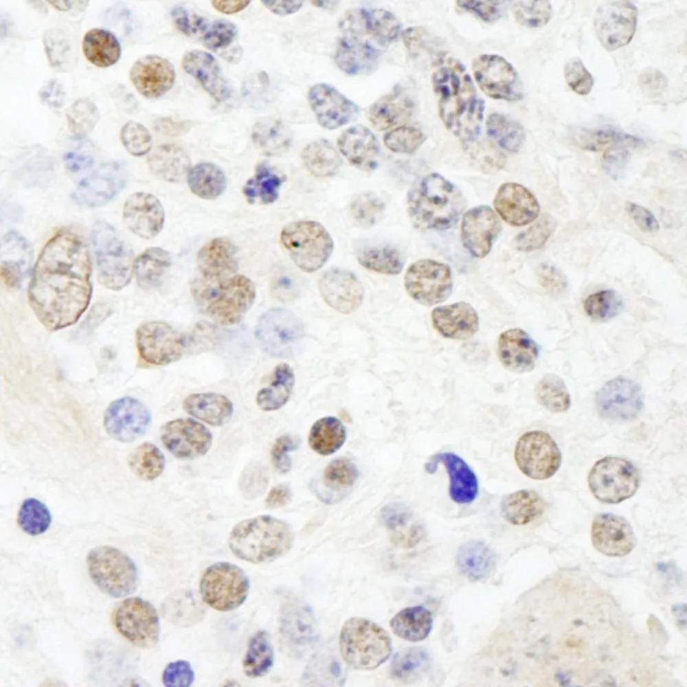 Rabbit anti-ANKS3 IHC Antibody, Affinity Purified