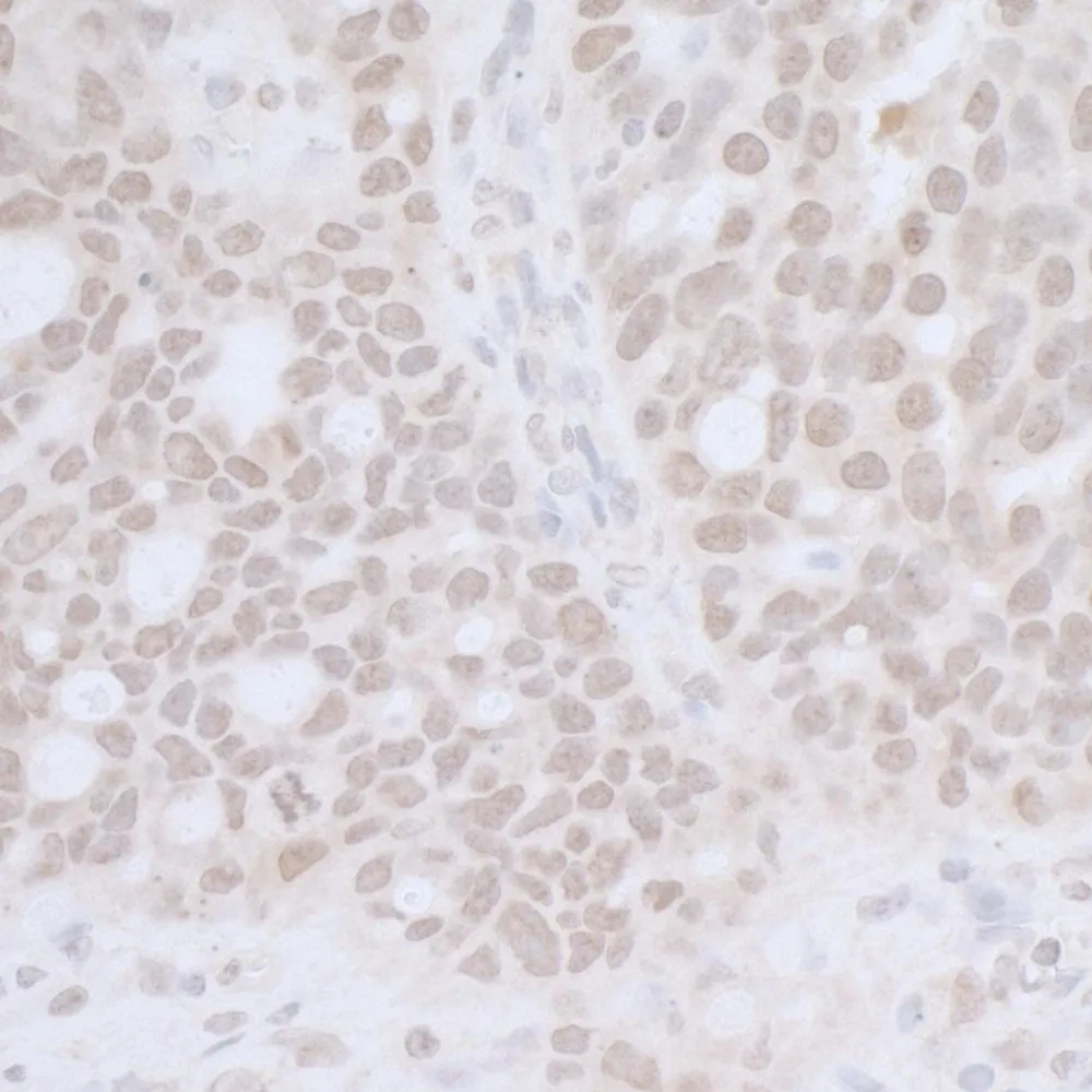Rabbit anti-CTR9 IHC Antibody, Affinity Purified