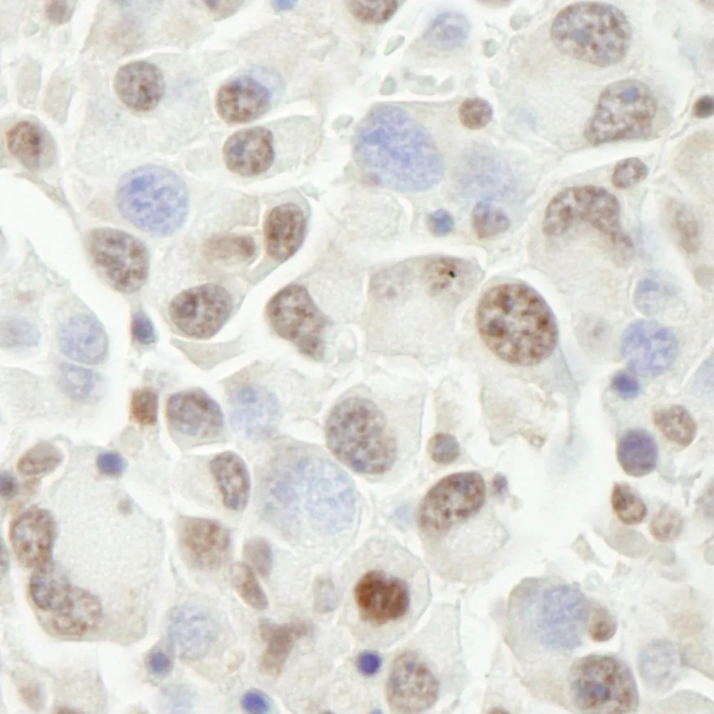 Rabbit anti-PHF6 IHC Antibody, Affinity Purified