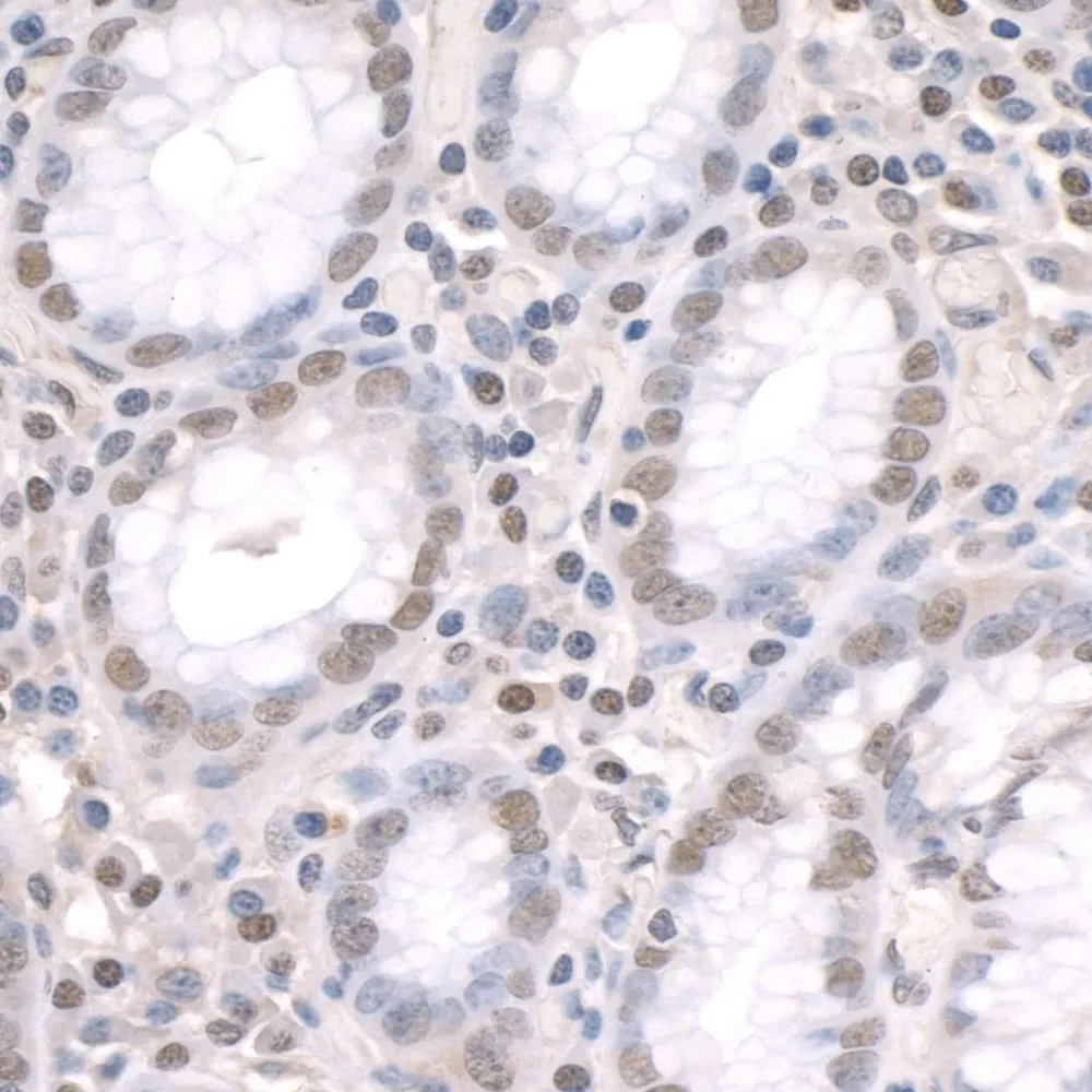 Rabbit anti-ZFP106 IHC Antibody, Affinity Purified