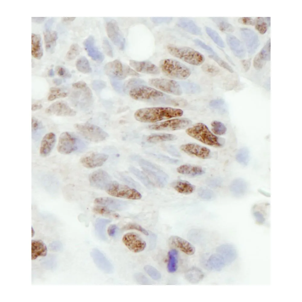Rabbit anti-ZC3H11A IHC Antibody, Affinity Purified