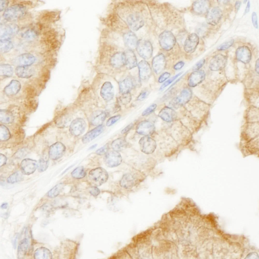 Rabbit anti-KANK2/SIP IHC Antibody, Affinity Purified