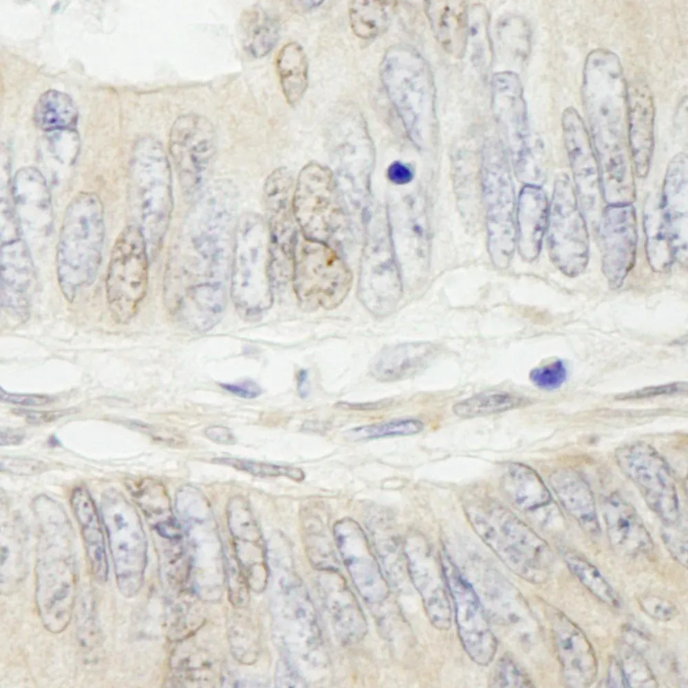 Rabbit anti-MYBBP1A IHC Antibody, Affinity Purified