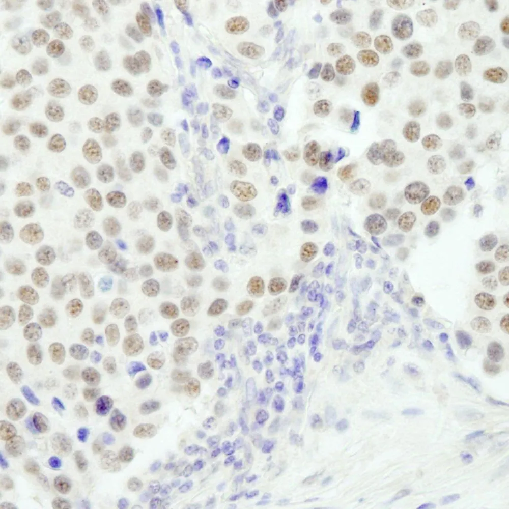 Rabbit anti-RCOR3 IHC Antibody, Affinity Purified