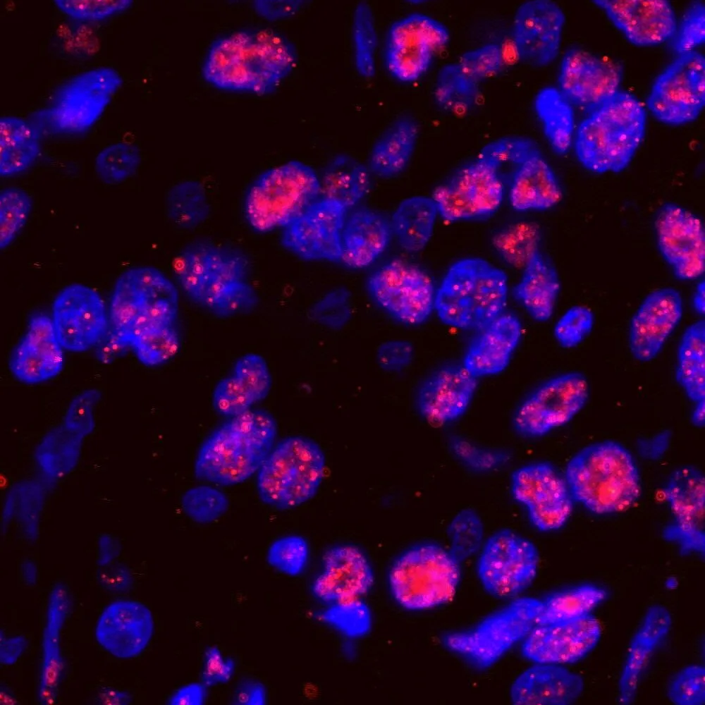 Rabbit anti-SF3a120/SAP114 IHC Antibody, Affinity Purified