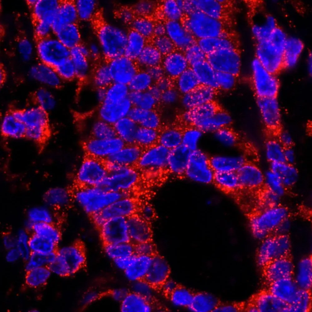 Rabbit anti-USP3 IHC Antibody, Affinity Purified