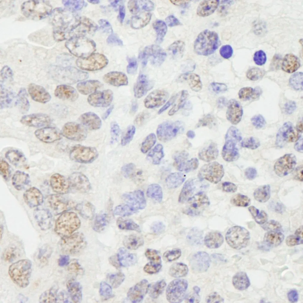 Rabbit anti-KPNA4 IHC Antibody, Affinity Purified