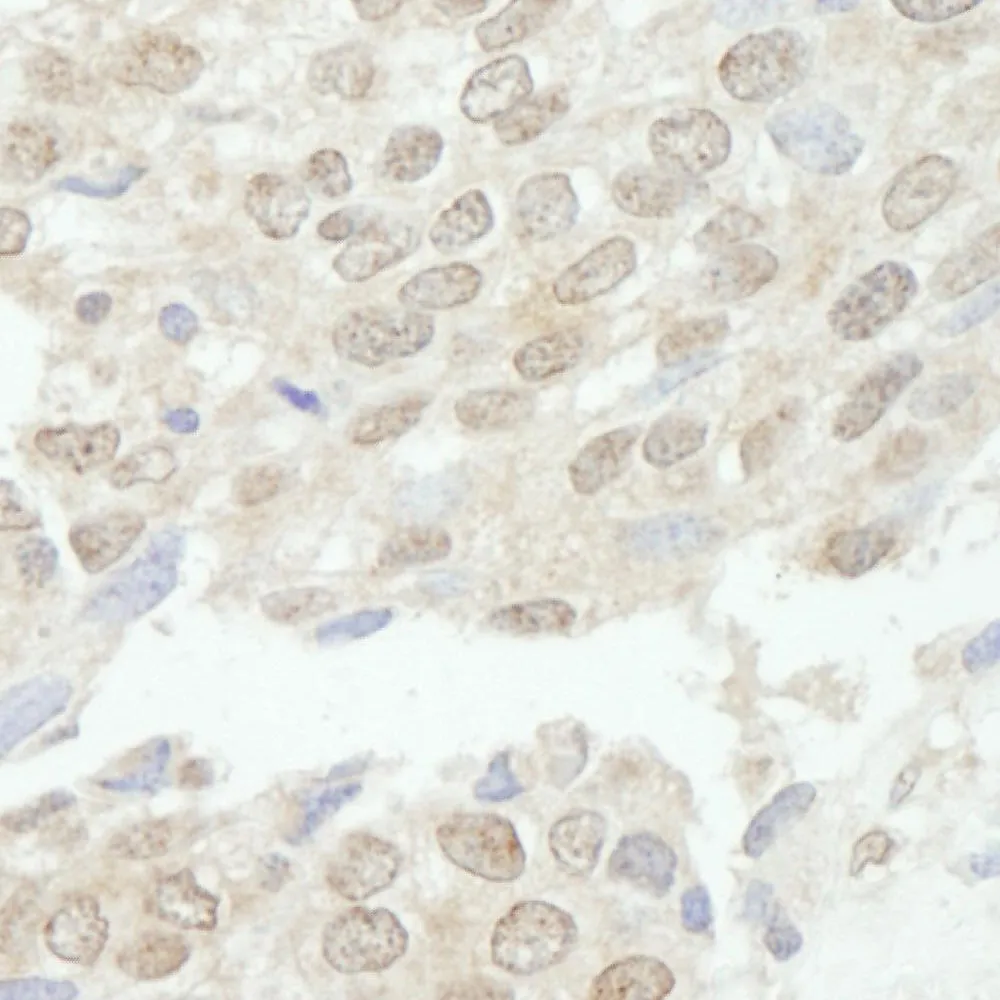 Rabbit anti-TDP1 IHC Antibody, Affinity Purified