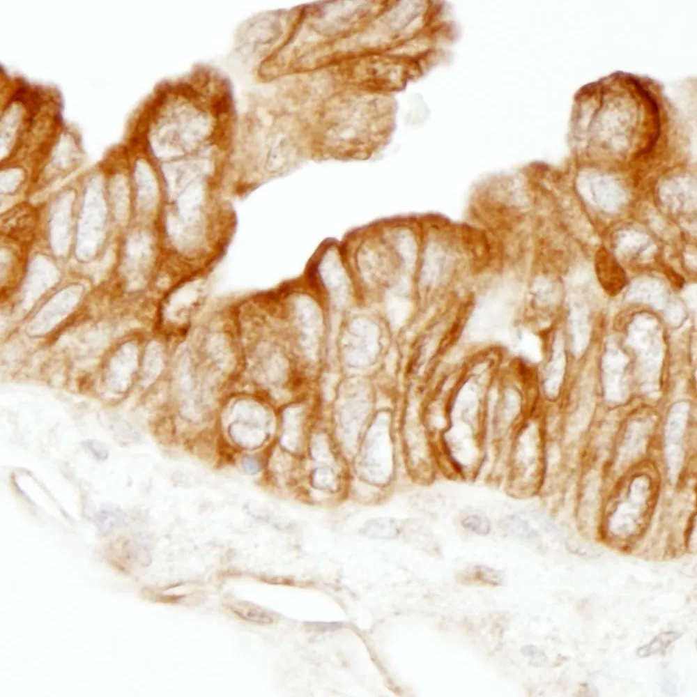 Rabbit anti-HPIP IHC Antibody, Affinity Purified
