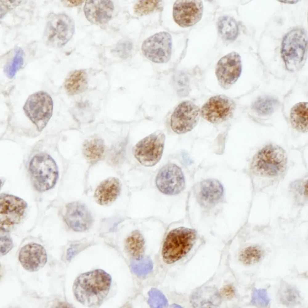 Rabbit anti-Fen1 IHC Antibody, Affinity Purified
