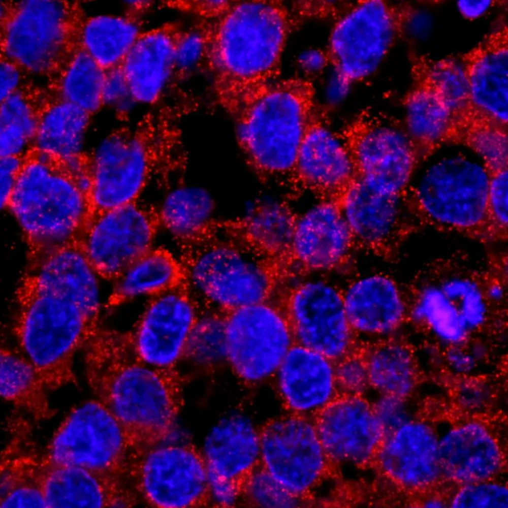 Rabbit anti-EPS15 IHC Antibody, Affinity Purified