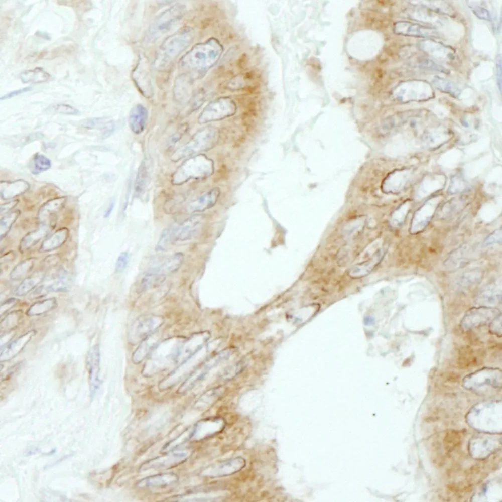Rabbit anti-Flightless-1 IHC Antibody, Affinity Purified