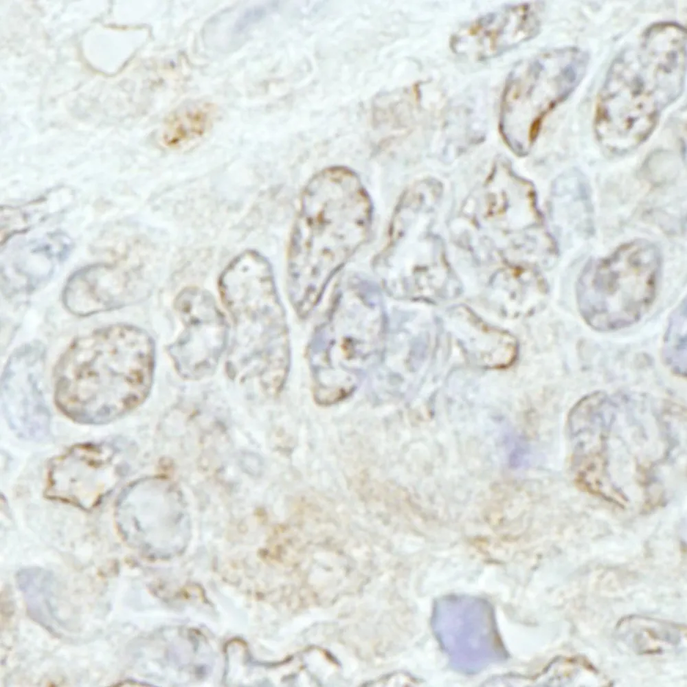 Rabbit anti-METTL3/MT-A70 IHC Antibody, Affinity Purified