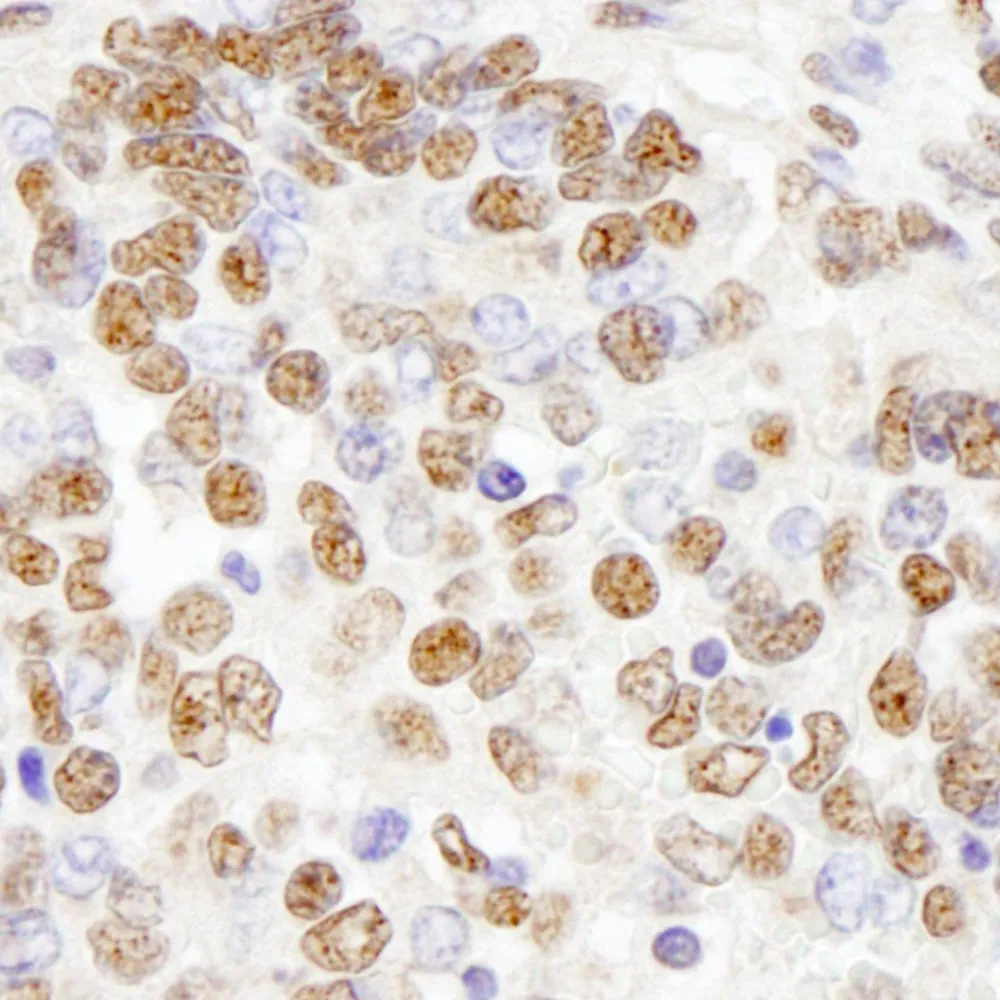 Rabbit anti-PHF8 IHC Antibody, Affinity Purified