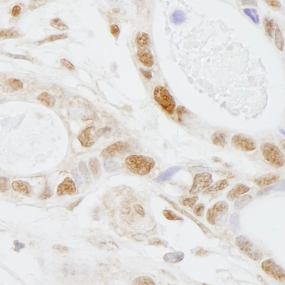 Rabbit anti-PUS1 IHC Antibody, Affinity Purified