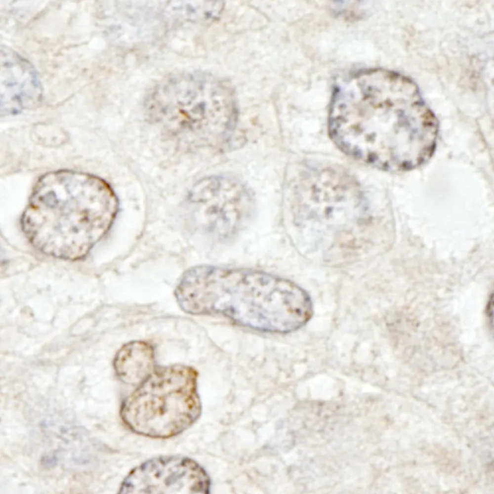 Rabbit anti-NUP50 IHC Antibody, Affinity Purified