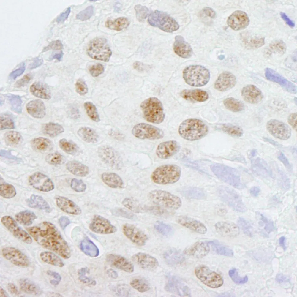 Rabbit anti-ZCCHC8 IHC Antibody, Affinity Purified