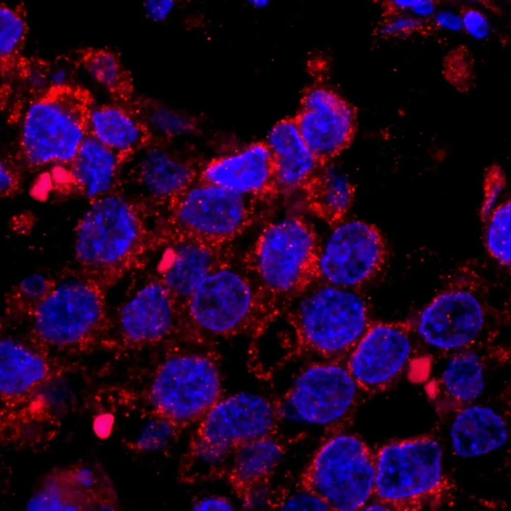 Rabbit anti-IRS2 IHC Antibody, Affinity Purified