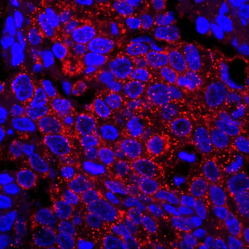 Rabbit anti-IRS1 IHC Antibody, Affinity Purified