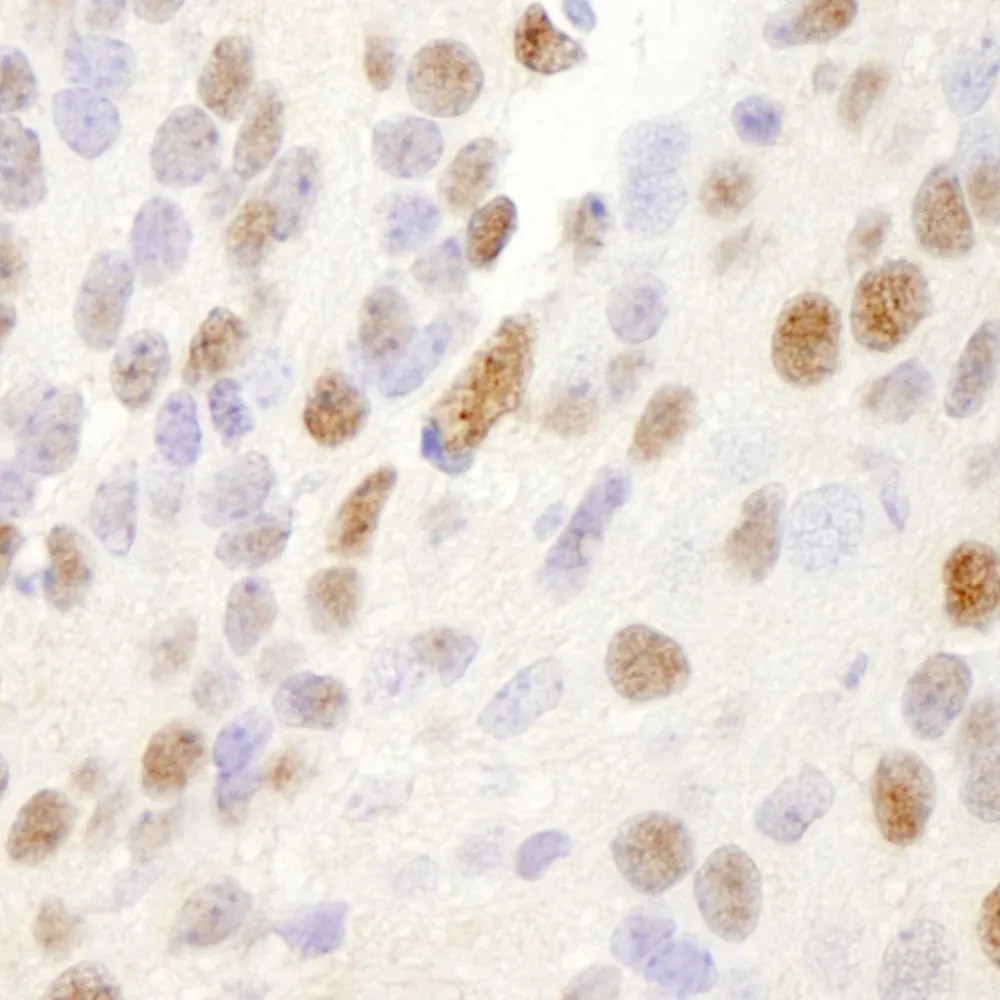 Rabbit anti-NRBF2 IHC Antibody, Affinity Purified