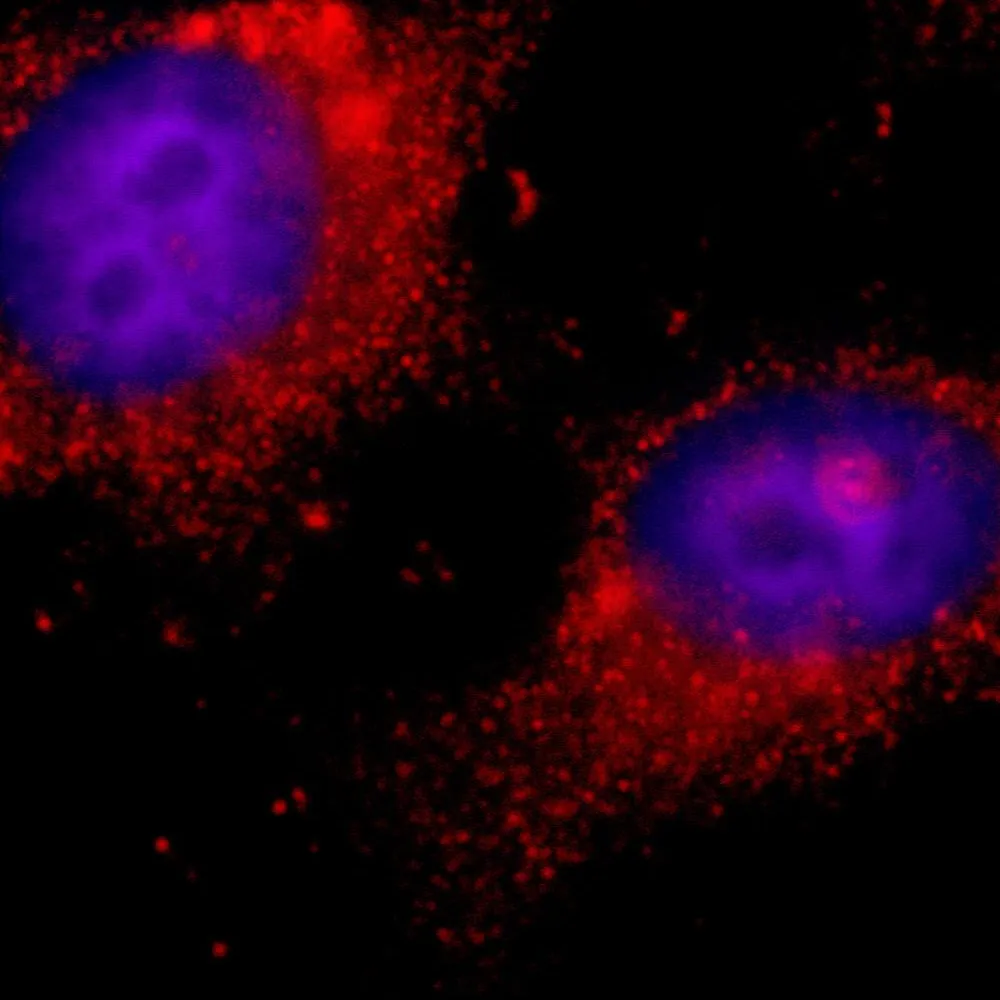 Rabbit anti-ILK IHC Antibody, Affinity Purified