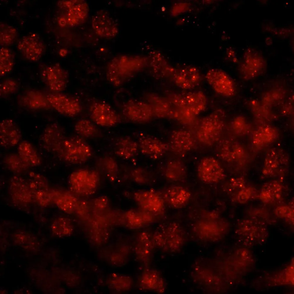 Rabbit anti-WTAP IHC Antibody, Affinity Purified
