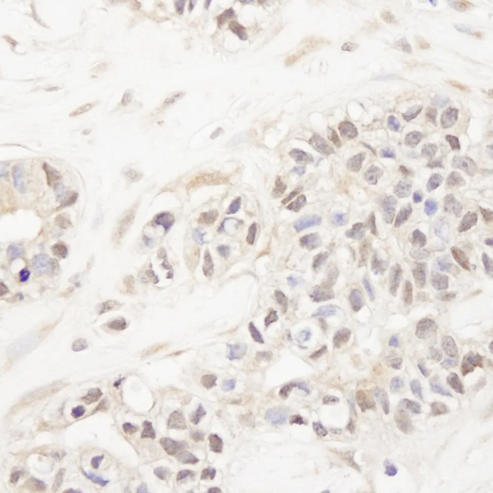 Rabbit anti-FOG1/ZFPM1 IHC Antibody, Affinity Purified