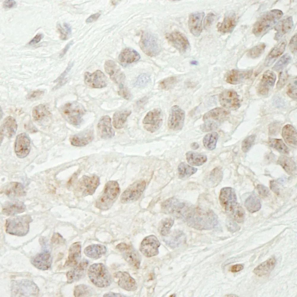 Rabbit anti-JARID1B IHC Antibody, Affinity Purified