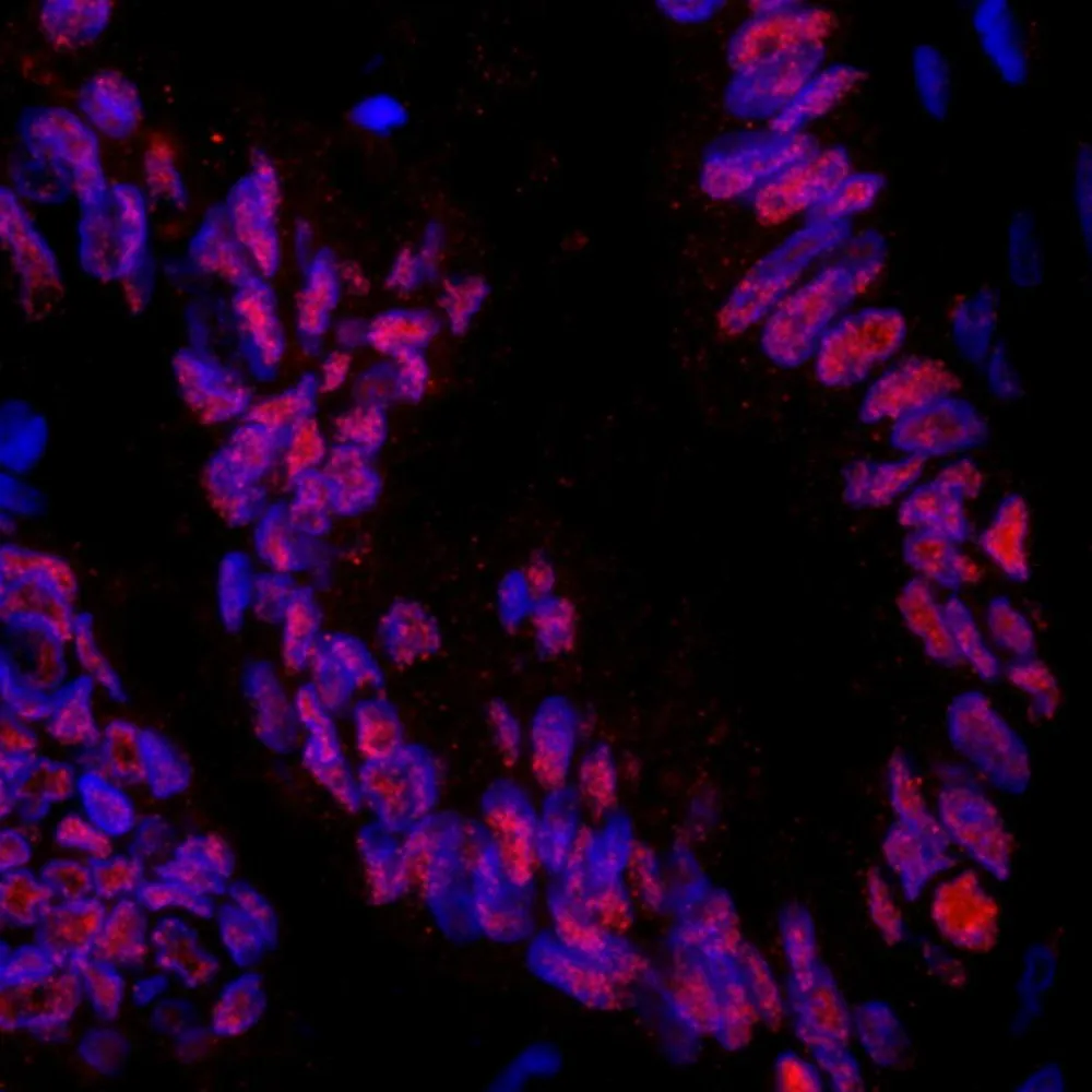 Rabbit anti-ZNF326 IHC Antibody, Affinity Purified
