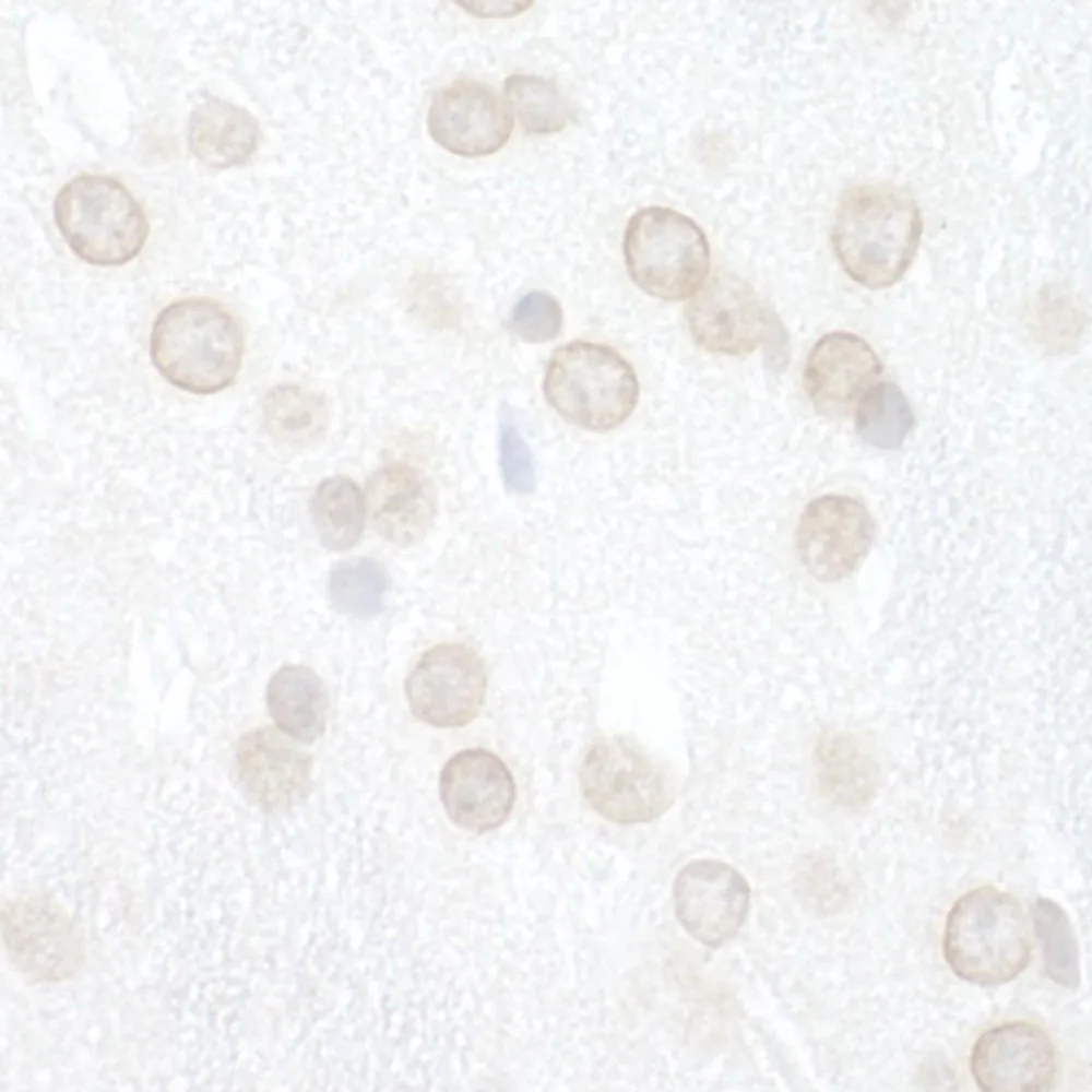 Rabbit anti-WDFY3 IHC Antibody, Affinity Purified
