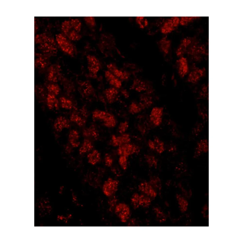 Rabbit anti-CTF18 IHC Antibody, Affinity Purified