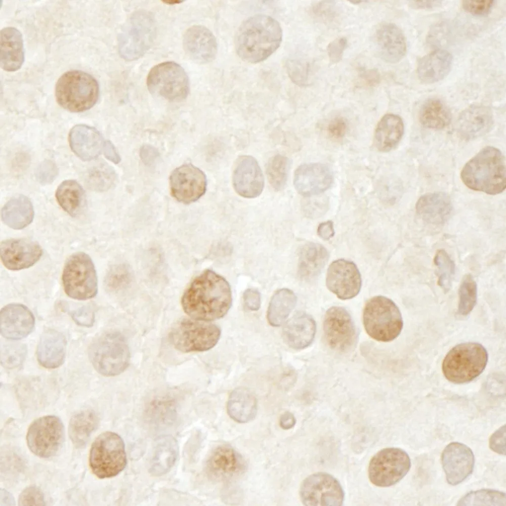 Rabbit anti-CDK2 IHC Antibody, Affinity Purified