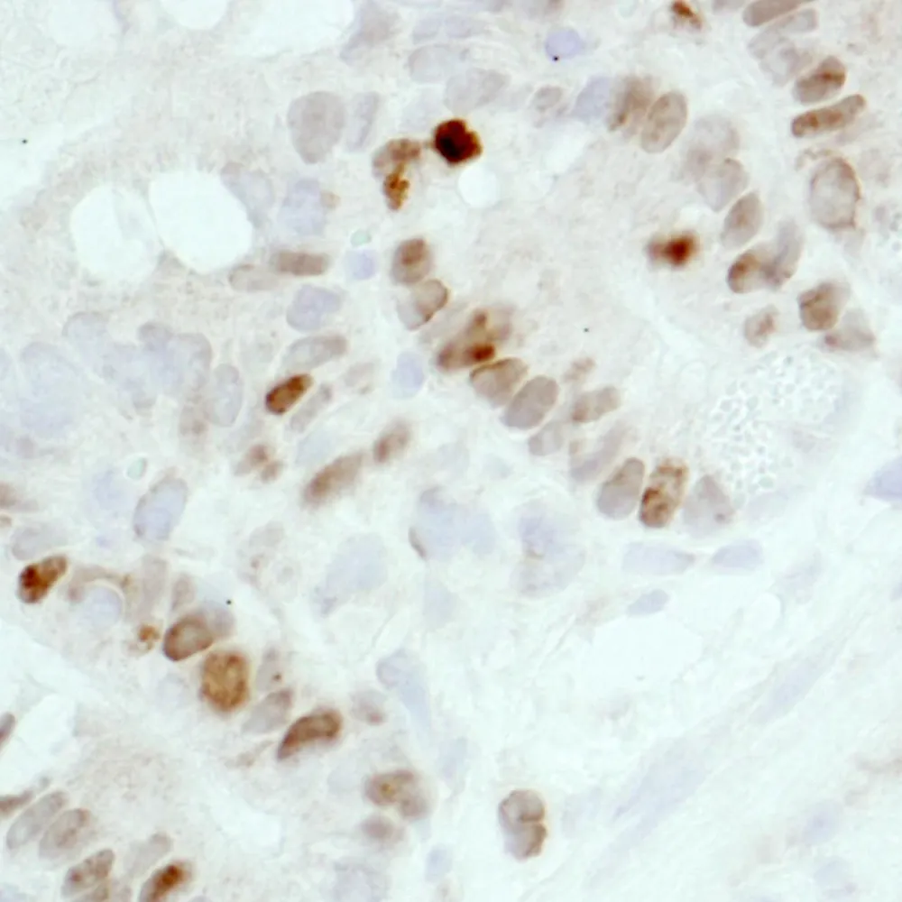 Rabbit anti-Ki-67 IHC Antibody, Affinity Purified