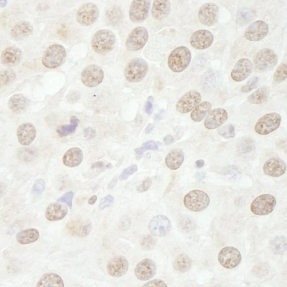 Rabbit anti-p66beta/GATAD2B IHC Antibody, Affinity Purified
