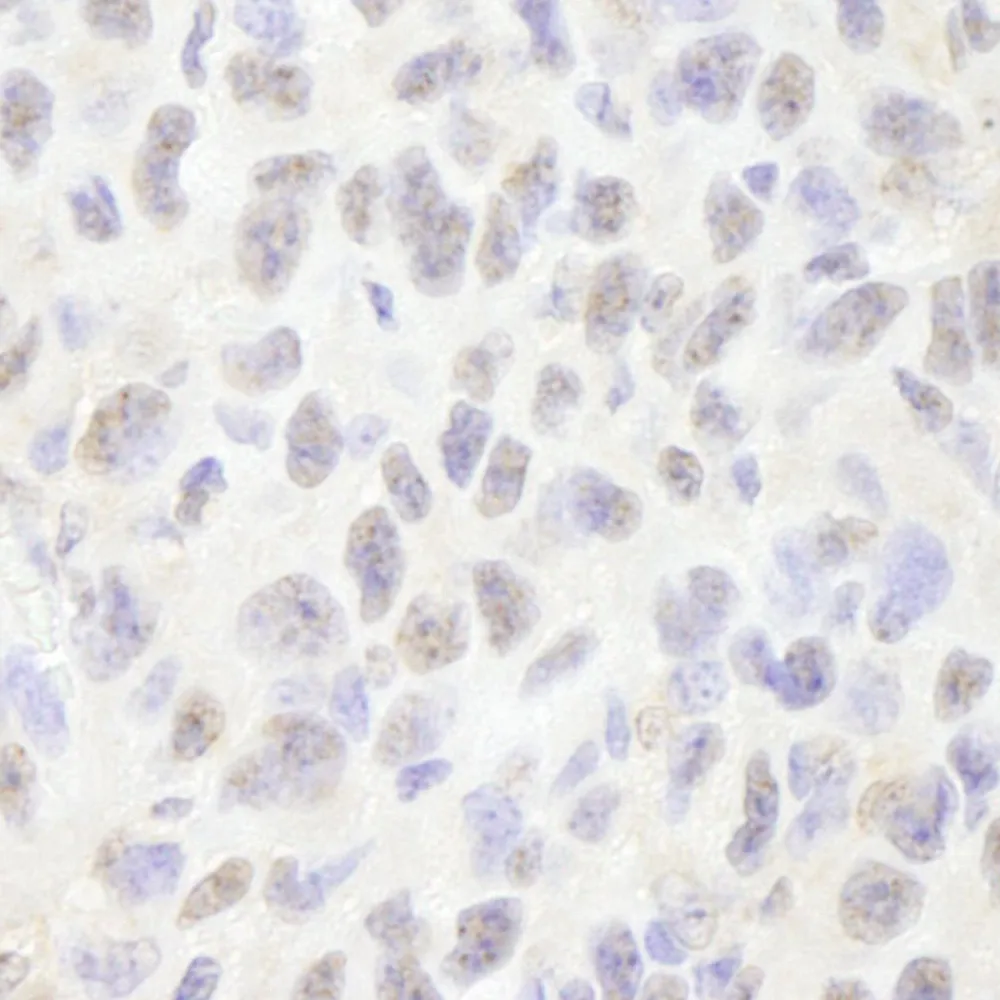 Rabbit anti-Pds5B IHC Antibody, Affinity Purified