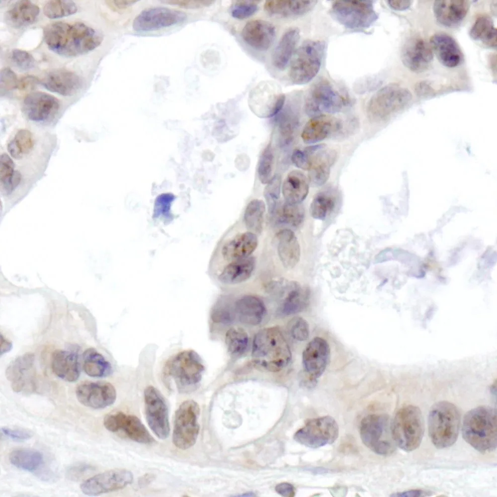 Rabbit anti-DHX15 IHC Antibody, Affinity Purified