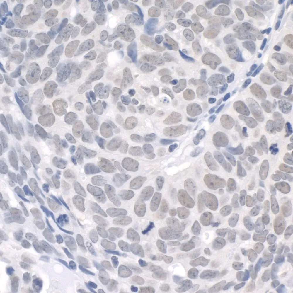 Rabbit anti-USP1 IHC Antibody, Affinity Purified