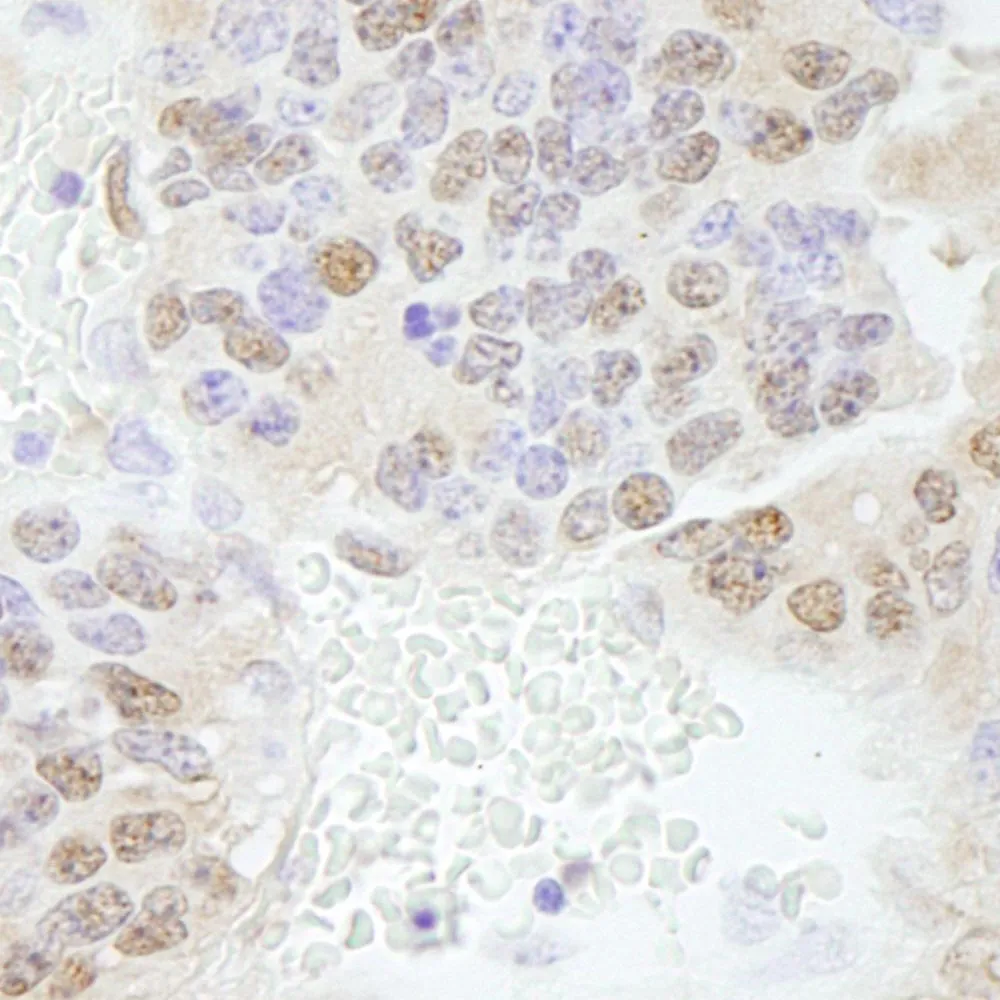 Rabbit anti-ERF IHC Antibody, Affinity Purified