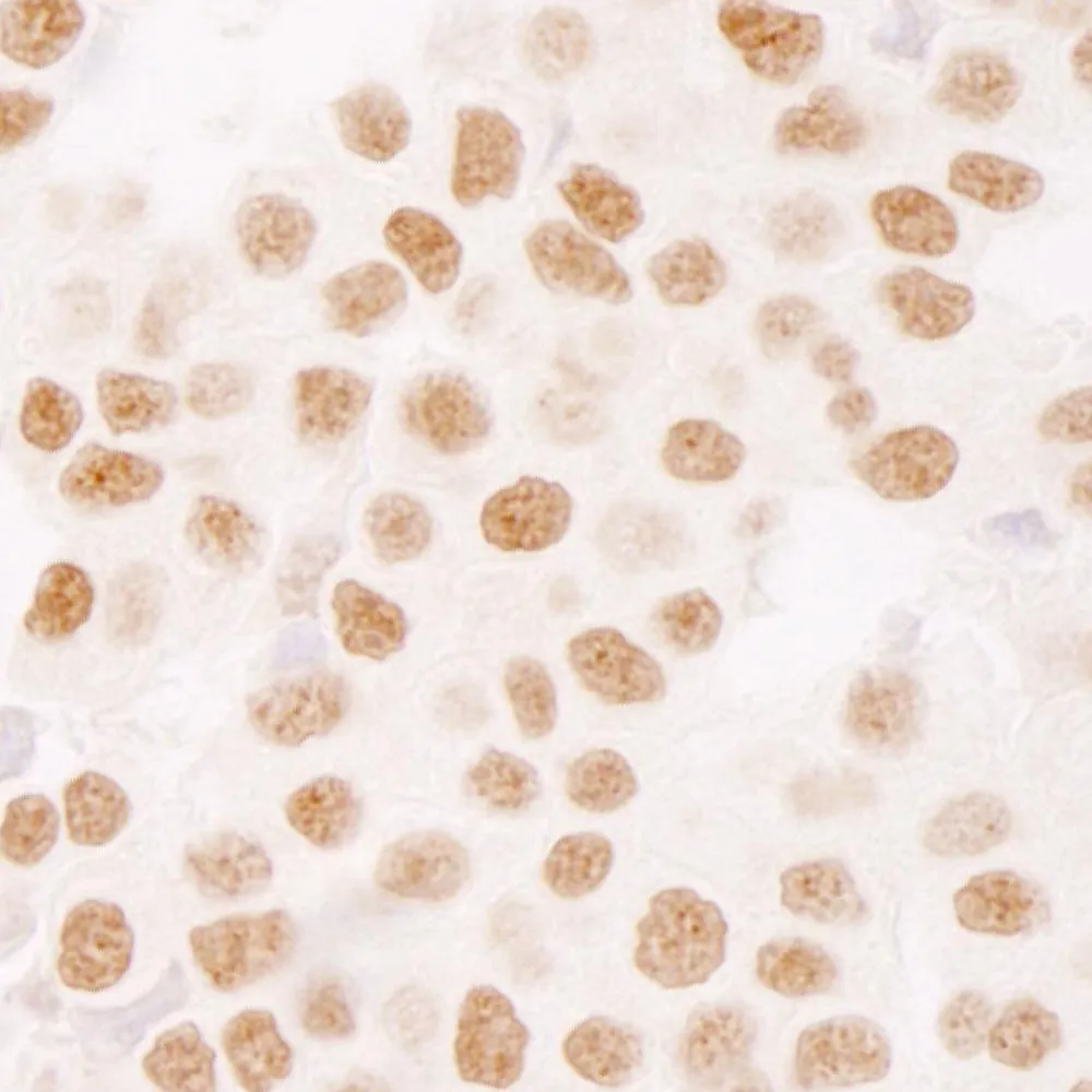 Rabbit anti-Ki-67 IHC Antibody, Affinity Purified