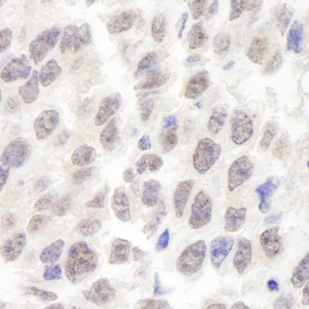 Rabbit anti-WRN IHC Antibody, Affinity Purified