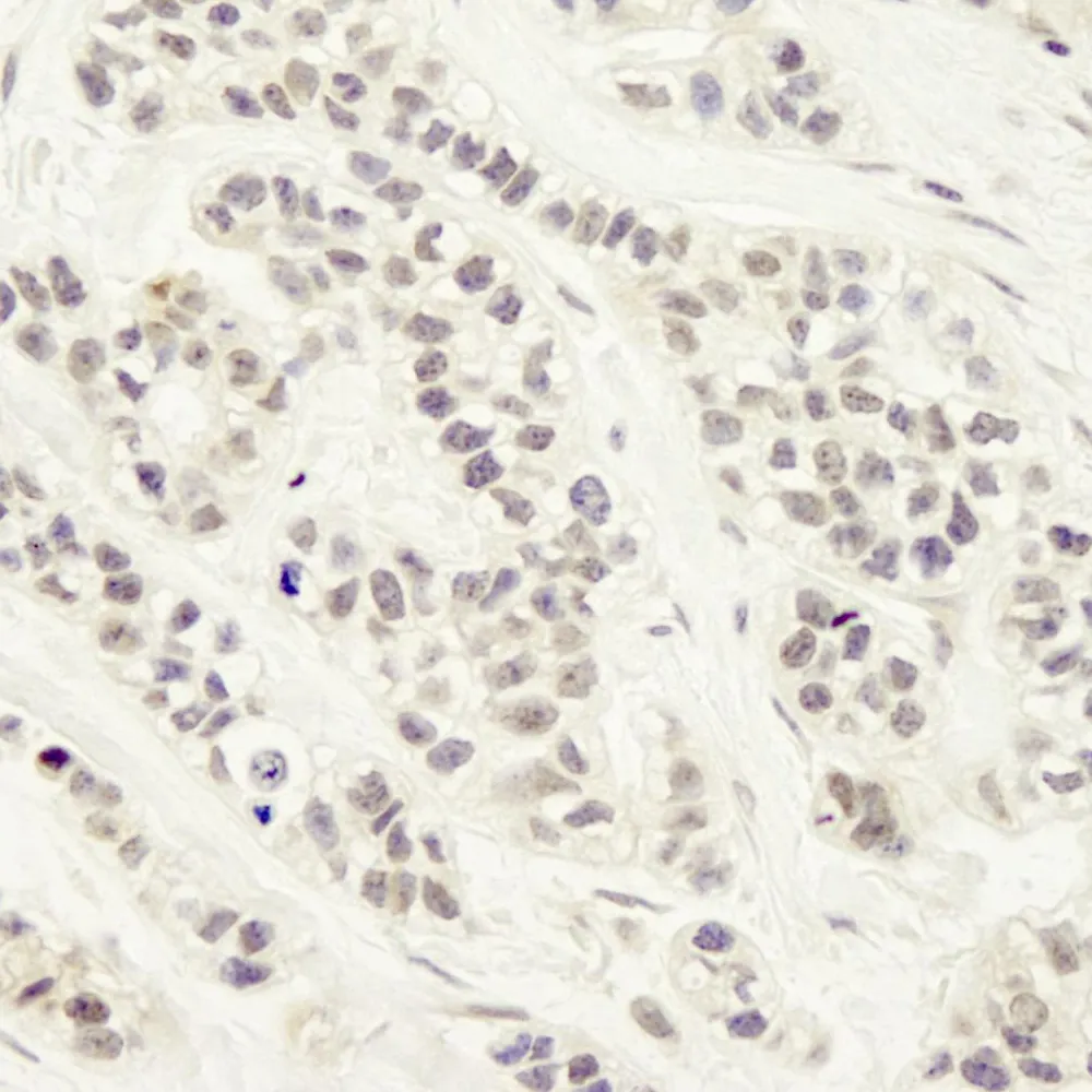 Rabbit anti-Artemis IHC Antibody, Affinity Purified