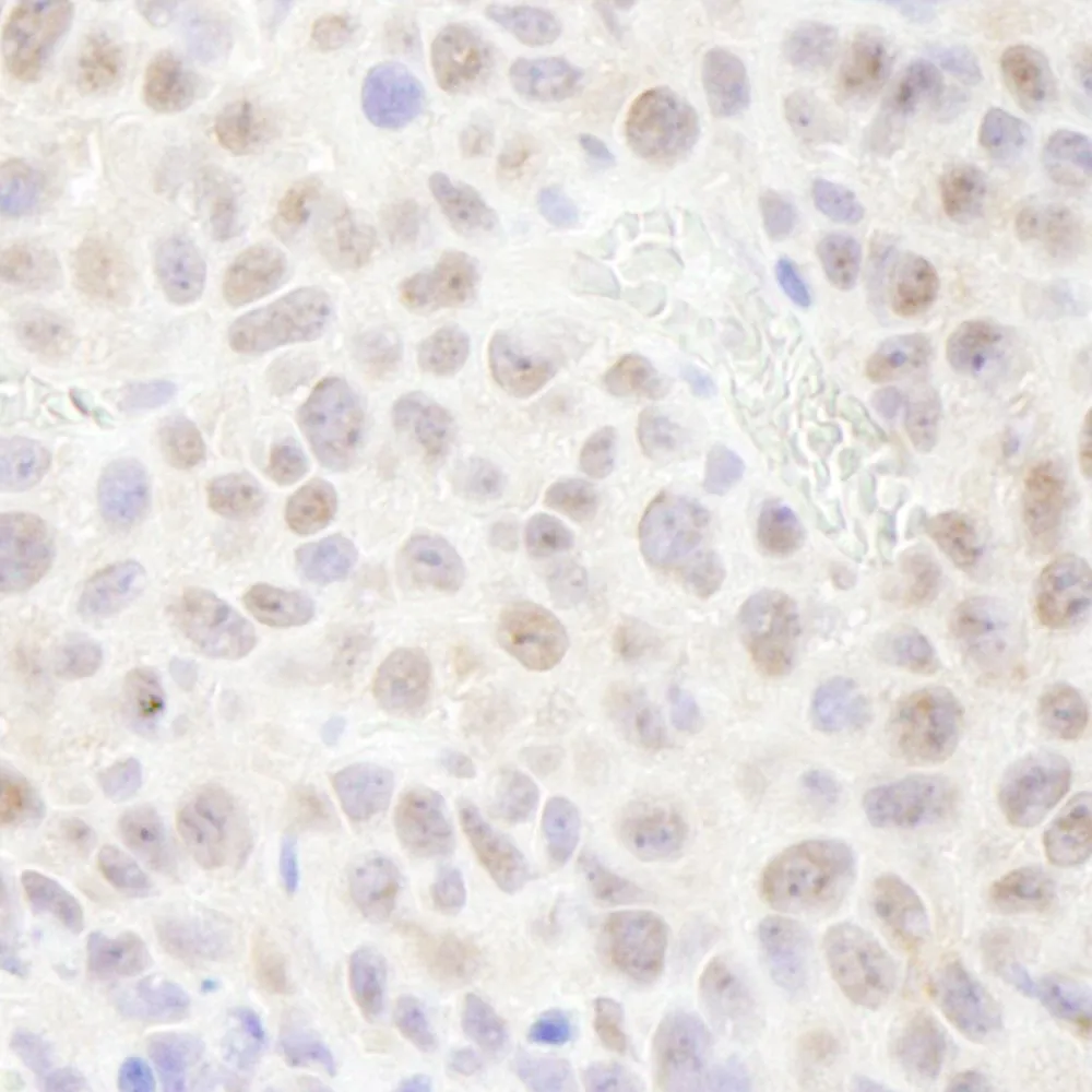Rabbit anti-RPA70 IHC Antibody, Affinity Purified
