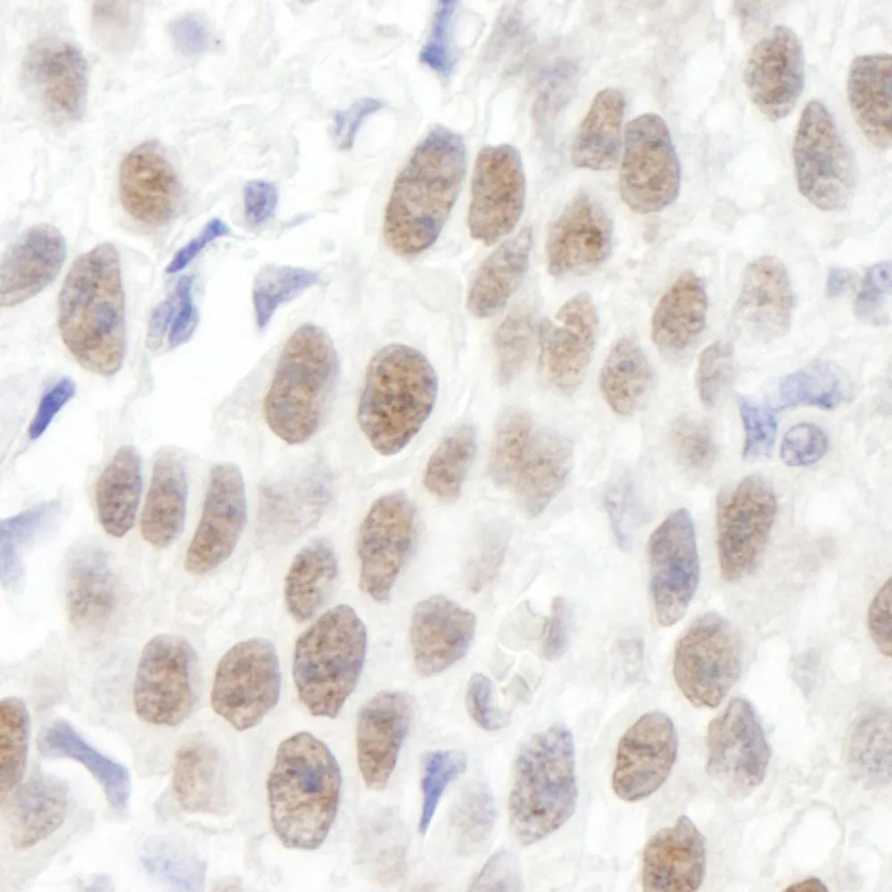 Rabbit anti-KIAA0082 IHC Antibody, Affinity Purified
