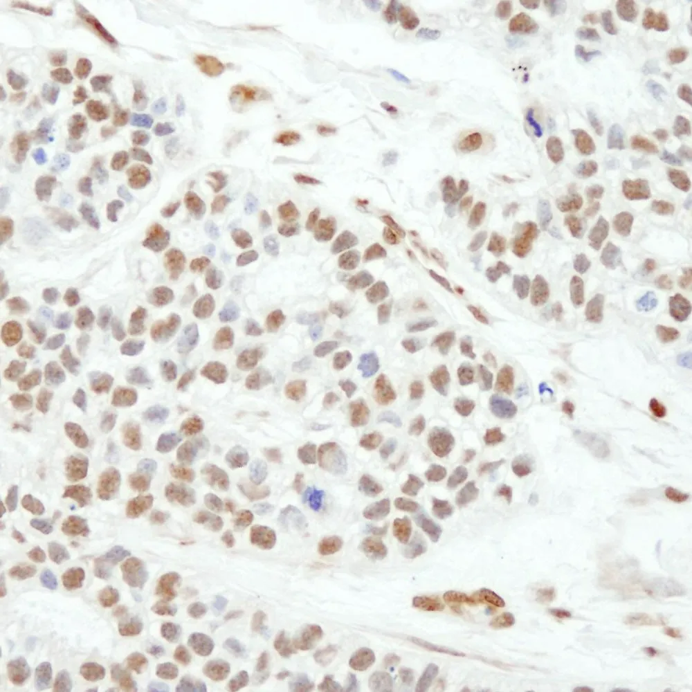 Rabbit anti-MAD2 IHC Antibody, Affinity Purified