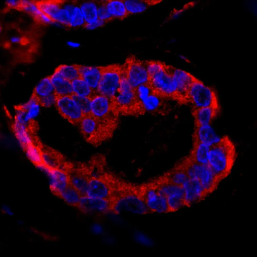 Rabbit anti-CC2D1A IHC Antibody, Affinity Purified