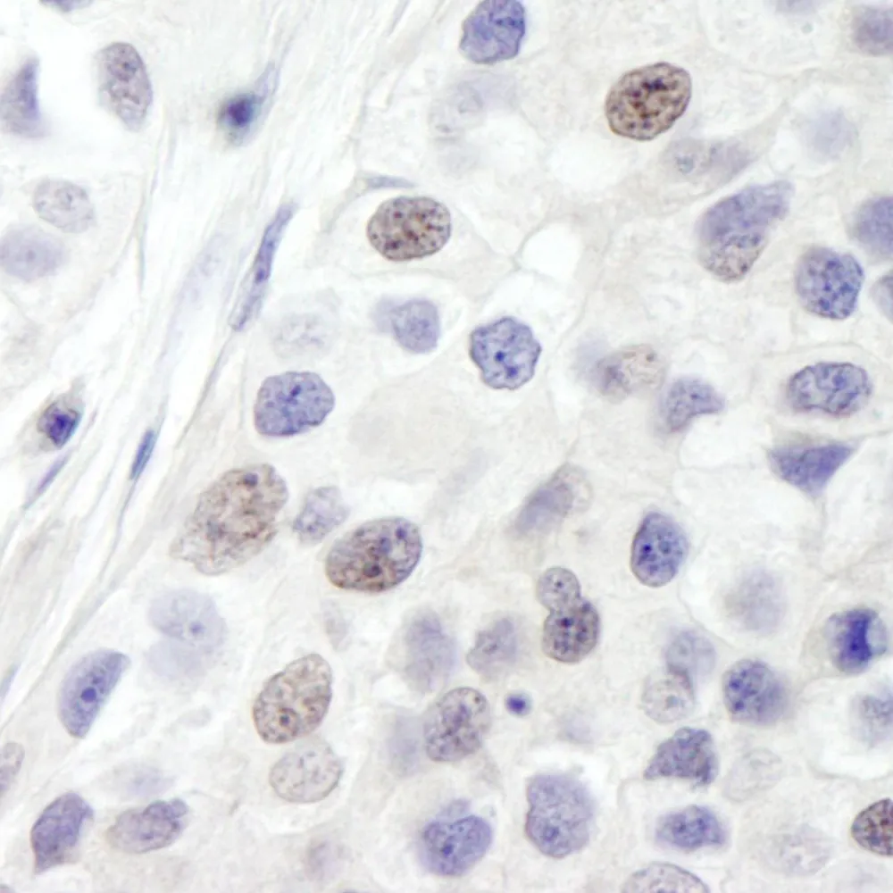 Rabbit anti-INT8 IHC Antibody, Affinity Purified