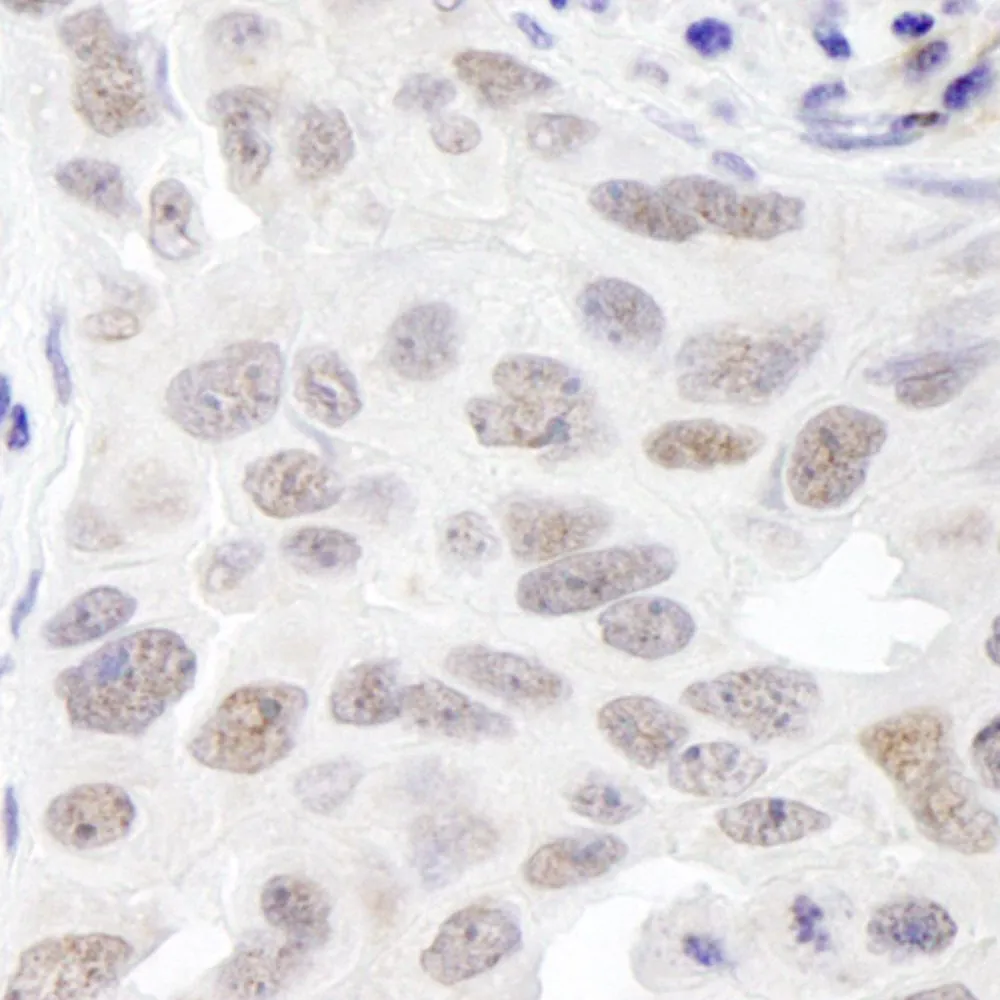 Rabbit anti-EMSY IHC Antibody, Affinity Purified