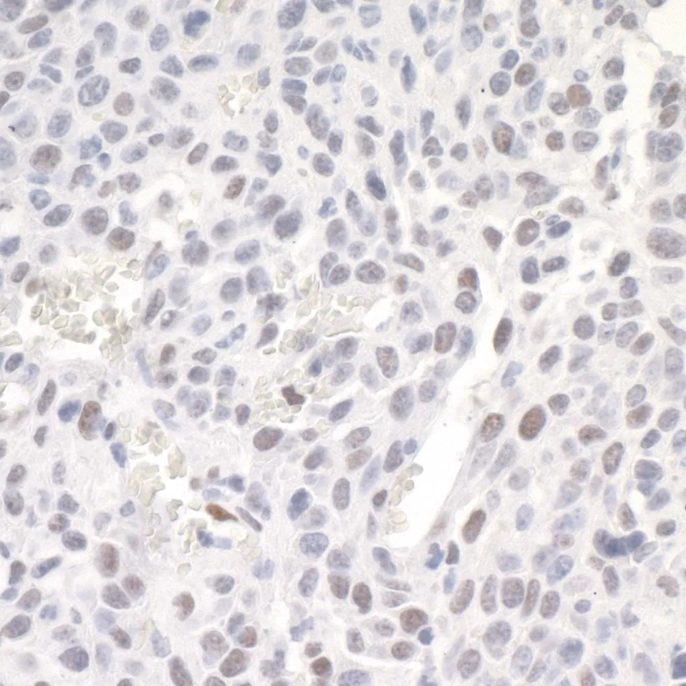 Rabbit anti-ZEB1 IHC Antibody, Affinity Purified