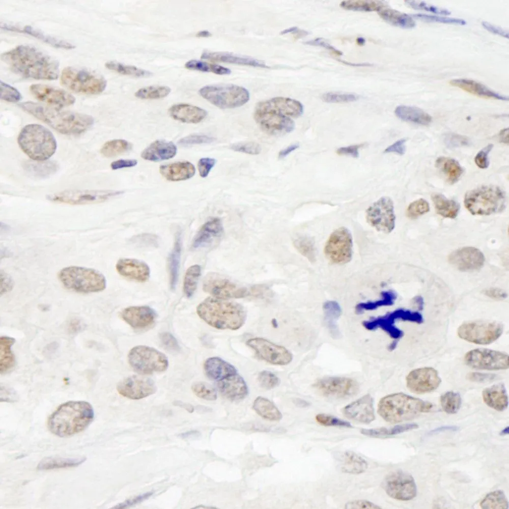 Rabbit anti-RAP1 IHC Antibody, Affinity Purified