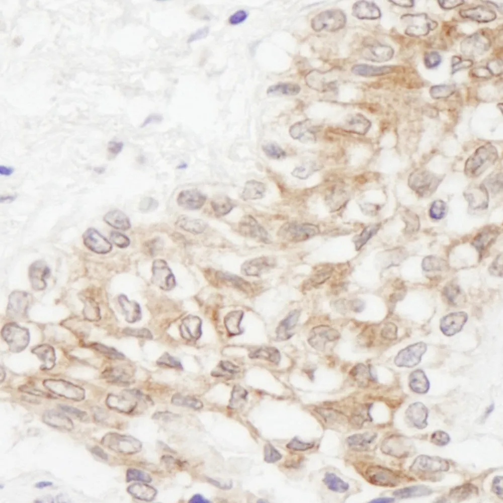 Rabbit anti-Rictor IHC Antibody, Affinity Purified